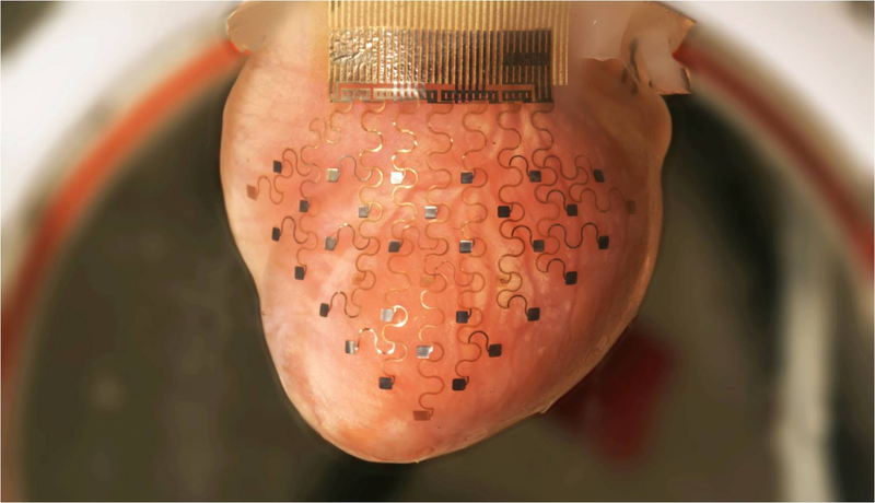 Illustration for article titled Crean una membrana artificial capaz de evitar ataques al corazón